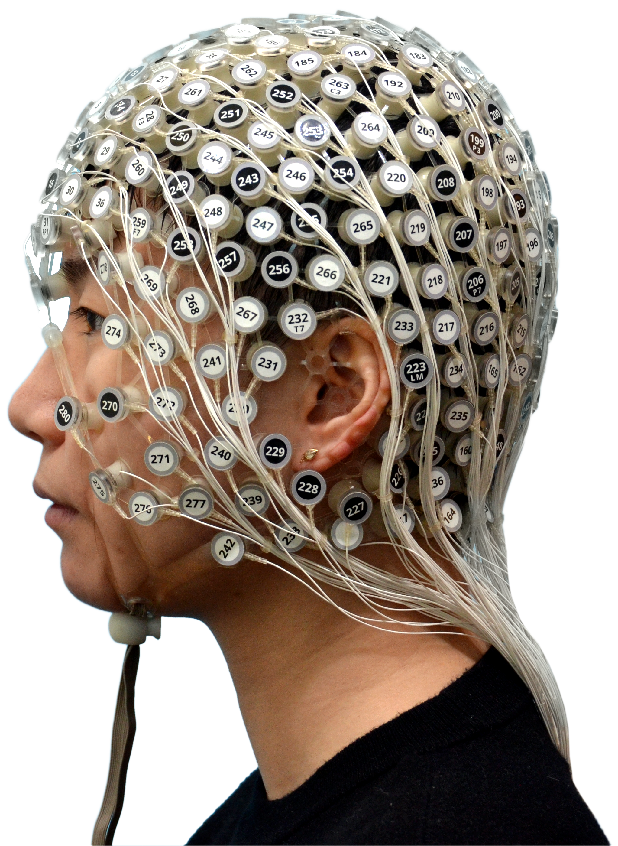 eeg 2008年 Different sustained and induced alpha oscillations emerge in